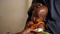 Two-year-old Mowlid eats a high protein peanut paste, also known as ready-to-use therapeutic food (RUTF), as treatment for his severe acute malnutrition. As part of our simplified approach, the IRC recommends providing RUTF as the primary treatment product for all children diagnosed with acute malnutrition.